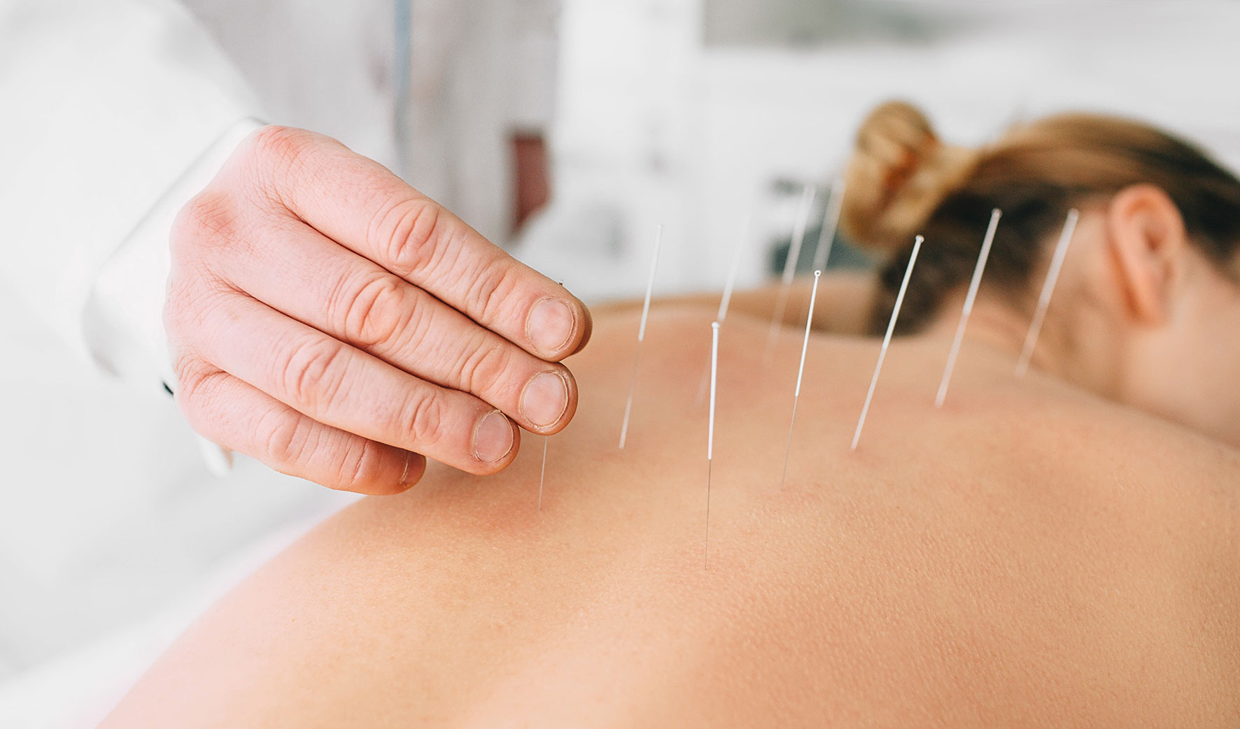 Acupuncture for Drug & Alcohol Rehab